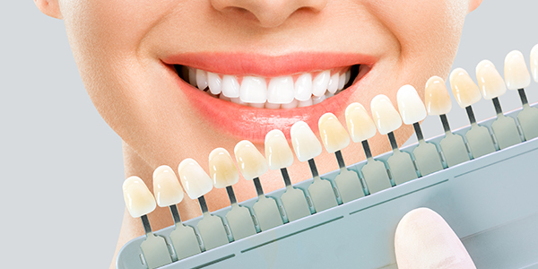 ホワイトニング