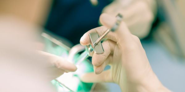 根管治療のイメージ