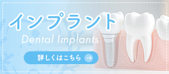 インプラント